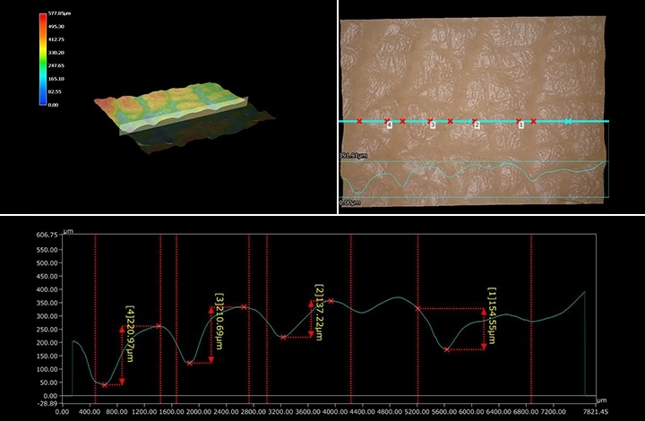 profilo 3D della superficie cutanea